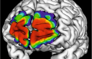 Der dreidimensionale zelluläre JuBrain-Atlas basiert auf mikrostrukturellen Kartierungen von zehn post mortem Gehirnen. Die Karten zeigen die Wahrscheinlichkeitsverteilungen als Maß für die interindividuelle Variabilität der anatomischen Areale im Hinblick auf Raum und Ausdehnung. Copyright: Forschungszentrum Jülich/HBP