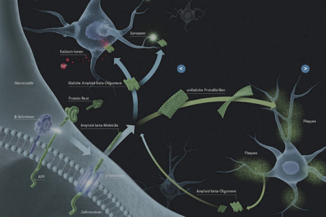 Die Bildung und Aggregation des Amyloid-beta-Proteins ist ein komplexer Prozess. Copyright: Illuteam43